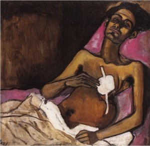 Tuberculosis in Harlem (1940), Alice Neel
